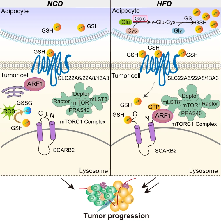 Tumor progression