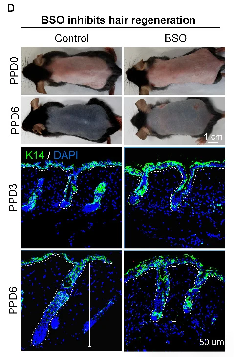 Figure 5. Glutathione (GSH) synthesis inhibitor BSO inhibits hair regeneration