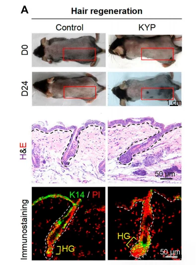 Figure 2 Hair regeneration induced by mitochondrial autophagy (statin 2) agonist KYP-2047