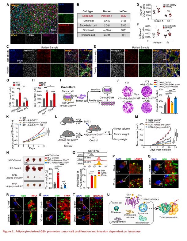 Adipocyte derived glutathione promotes obesity-related breast cancer