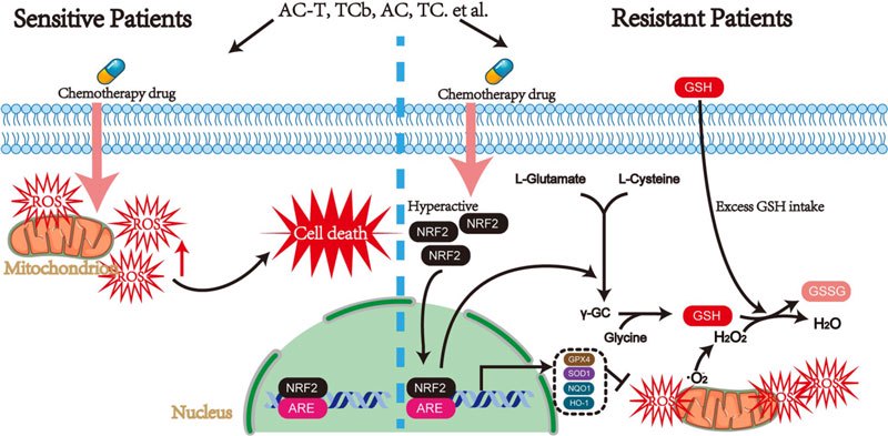 Map of antioxidant mechanisms in chemotherapy resistant and chemotherapy sensitive patients