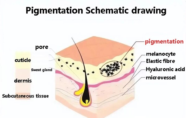 Pigmentation Schematic drawing