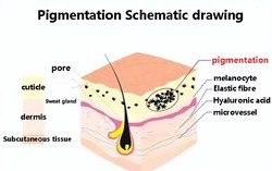 Glutathione whitening freckle anti-aging