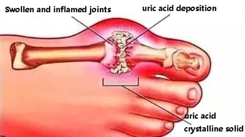 Glutathione is involved in most chronic diseases